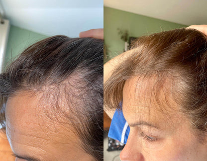 Crown & Bloom™ - Follicle Stimulating + DHT Blocking Botanical Hair Growth Serum