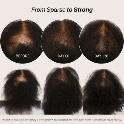 Crown & Bloom™ Botanical Scalp & Hair Serum